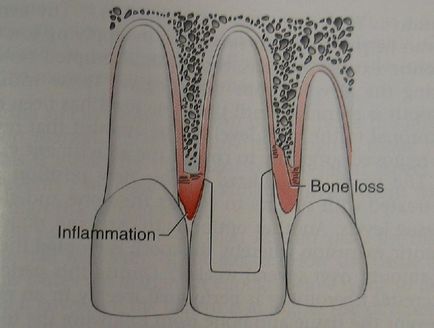 Dental-ревю, референтния биологичен ширина (биологичната ширина)