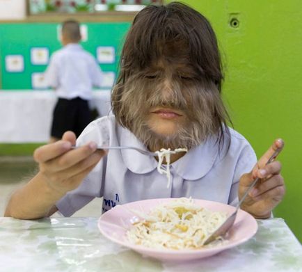 Дівчинка з пранаком (pranakom), передмістя, Bangkok, стала відома завдяки рідкісної аномалії -