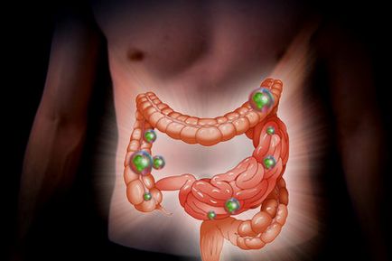 Diet egy dysbacteriosis