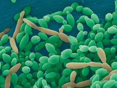 Diéta rigó (candidiasis) a férfiak és a nők a jobb étel, a termékek listáját, és egyéb (étel) Diéta rigó (candidiasis) a férfiak és a nők a jobb étel, a termékek listáját, és egyéb