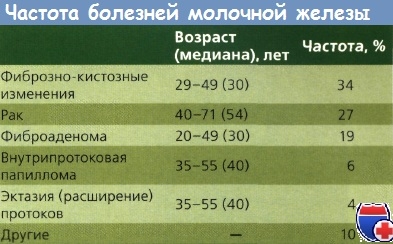 Доброякісні освіти молочної залози - частота, епідеміологія