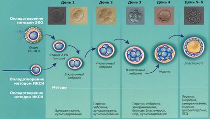 Ембріологічний етап по днях - результат після процедури, відгуки, протоколи еко в клініці Карменту