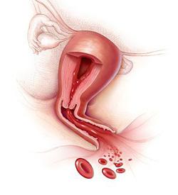 Dacă menstruația este de 2 zile