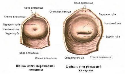 Якщо лікар знайшов «ерозію»