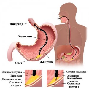 Prepararea FGS pentru examinarea stomacului