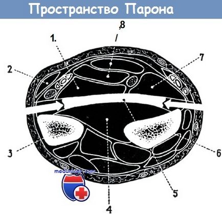 Antebrațul fantezie (vaporii spațiului) - diagnostic, tratament