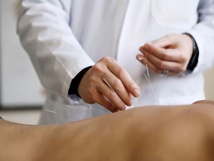 Acupunctura de la fumat argumente pro și contra ale acestei metode