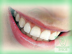 Implantarea dinților suturii - dinți implantabili imens în cartierul nord-estic (grămezi)
