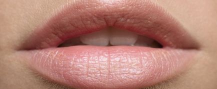 Як роблять пластику губ повний опис, поради та рекомендації