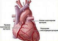 Arterele coronare - stenting