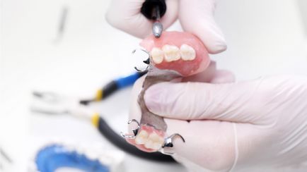 Корекція зубних протезів в москві, ціни, відгуки про клініки