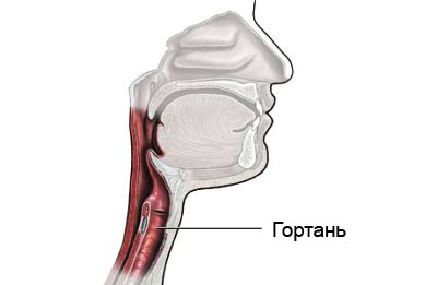 Tratamentul disfoniei - portal medical eurolab