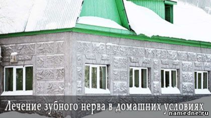 Лікування зубного нерва в домашніх умовах - ротова порожнина - лікування хвороб - народні рецепти