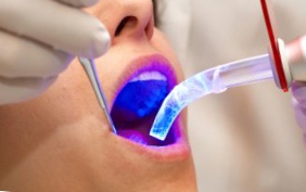 Tratarea cu laser a dinților rapid și eficient