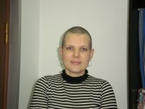 Chelie femei și păr după chimioterapie, cancerul nu este o sentință! Cum să devii sănătos dacă este diagnosticat cu cancer,