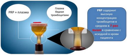 Методика отримання prp