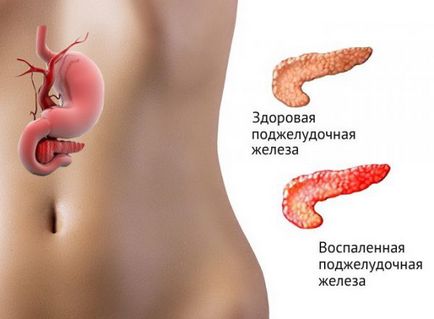 Чому болить підшлункова залоза причини, симптоми, лікування