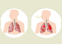 Cauzele și simptomele astmului bronșic
