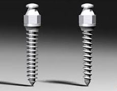 Utilizarea mini-implanturilor în ortodonție