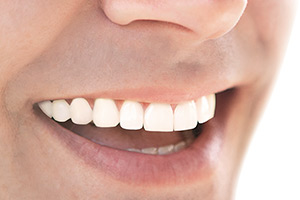 Протезування (відновлення) зубів, зубні протези, коронки