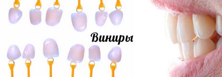 Az ortopéd fogászati ​​árak, típusok, Moszkva