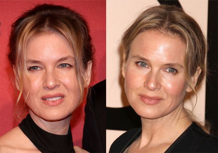 Investigarea rena zellweger din plastic