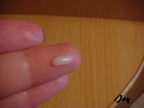 Roc ránc correxion - hat a ráncok a sejtek szintjén értékelés (Eye Cream) Roc ránc correxion - hat a ráncok a sejtek szintjén vélemények