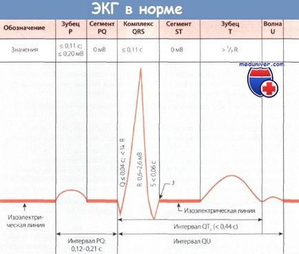 Szegmens s-t EKG