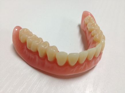 Знімні зубні протези плюси і мінуси конструкцій