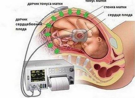 Palpitații în abdomenul sarcinii