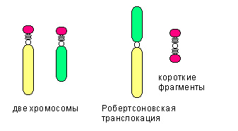 Синдром Патау (трисомія по 13 хромосомі) і синдром Едвардса (трисомія по 18 хромосомі)