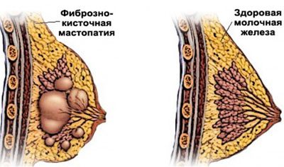 Сонячне випромінювання і його вплив на організм людини