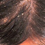 Поради по догляду за яскраво фарбованим волоссям