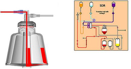 Tehnologia serviciului de sânge, delir, tehnologia aferezei automate