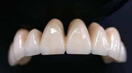 Технології -Зубний протези-часто задаються про протезуванні