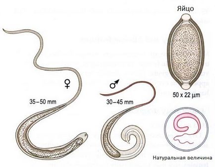 Trichocephalosis (Ostorféreg) - tünetek, diagnózis, kezelés