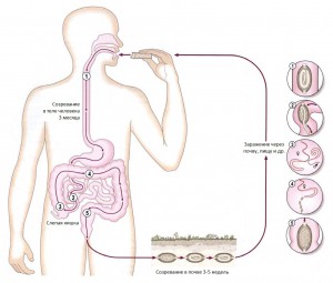 Trichocephalosis (descărcare vaginală) - simptome, diagnostic, tratament