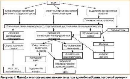 Tromboembolismul algoritmilor arteriali pulmonari pentru diagnostic și tratament, ediția online - știri despre medicină