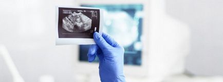 Ultrahang vizsgálat a MP Nordin kismedencei ultrahang és a hasüreg