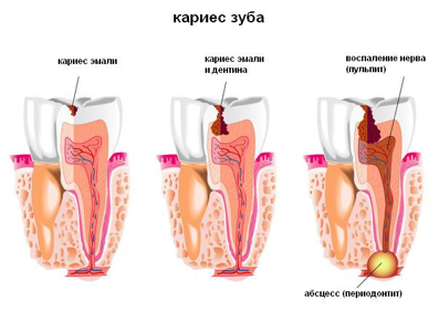 Послуги - дитяча стоматологія