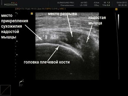 Узі суглобів узі плечового, колінного, суглобів, лучезапястного, кисті і ліктьового суглобів