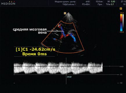 Венозна дисциркуляцію в дитячому та підлітковому віці - цоколь а