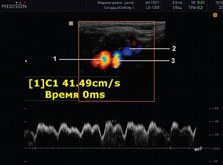 Discirculație venoasă în copilărie și adolescentă - soclu capsule