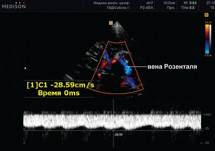 Венозна дисциркуляцію в дитячому та підлітковому віці - цоколь а