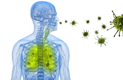 Pneumonia virală la adulți cu simptome, tratament și cauze
