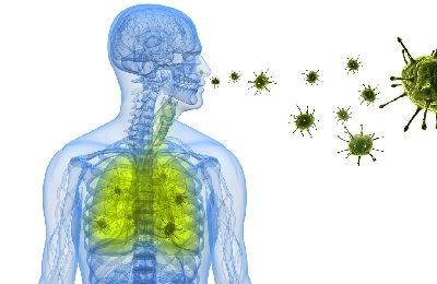 Vírusos tüdőgyulladás tünetei felnőtteknél, kezelése és okai