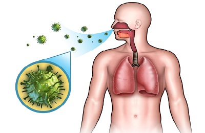 Pneumonia virală la adulți cu simptome, tratament și cauze