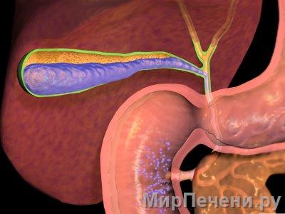 Cholecystitis felnőtteknél