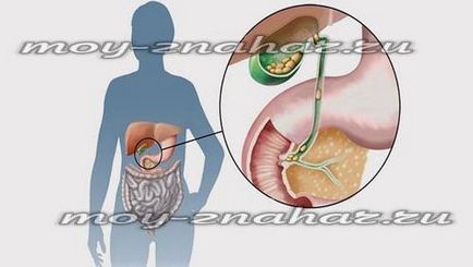 Tratamentul maladiei biliară fără intervenție chirurgicală, dietă