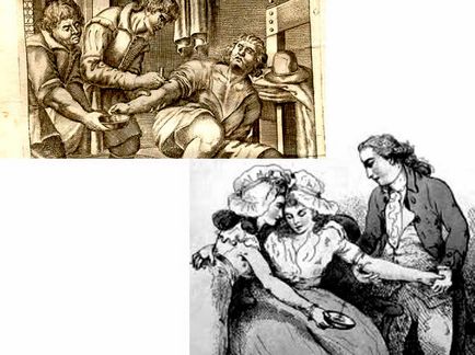 10 tratamente nebune în istoria medicinei